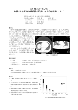 320 列 ADCT による 心臓 CT 検査時の呼吸停止不良に対する有効性
