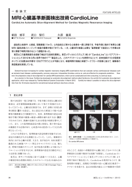 MRI心臓基準断面検出技術 CardioLine（614KB/PDFデータ）