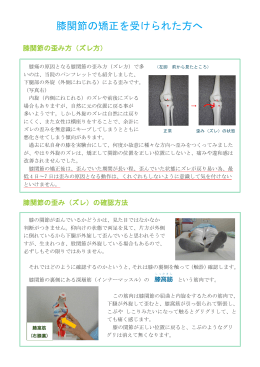 膝関節の矯正を受けられた方へ（pdfファイル）