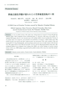卵巣広範性浮腫が疑われた小児卵巣茎捻転の1例