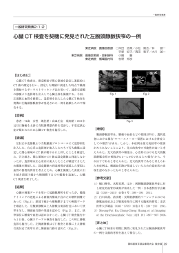 心臓 CT 検査を契機に発見された左腕頭静脈狭窄の一例