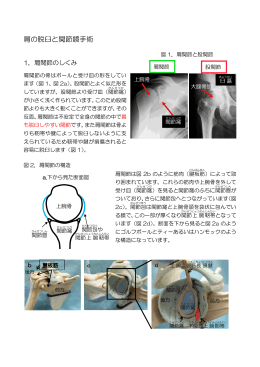 肩の脱臼と関節鏡手術