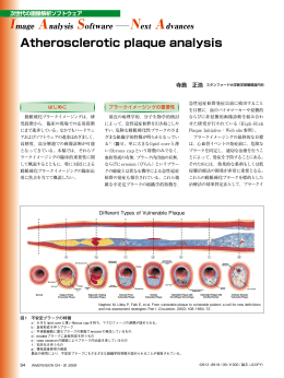 Atherosclerotic plaque analysis