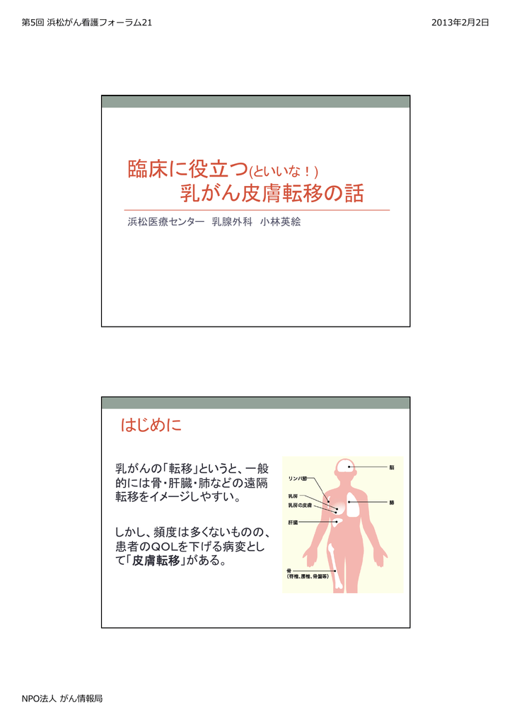 臨床に役立つ といいな 乳がん皮膚転移の話