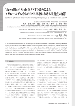 ViewaBlue&reg; Stain KANTO染色によるアガロース