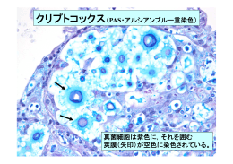 代表的な真菌