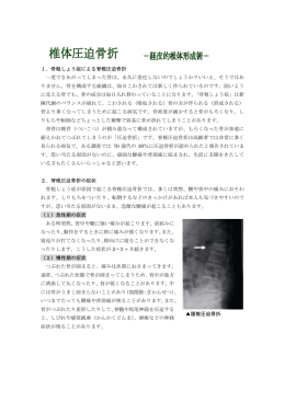 椎体圧迫骨折 - 亀田メディカルセンター