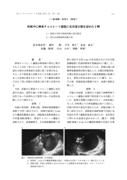 妊娠中に卵巣チョコレート囊胞に充実部分像を認めた 例