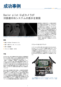 Basler pilot GigEカメラが3D医療外科システムを作成