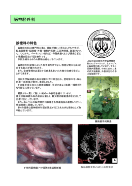 脳神経外科 - 信州大学