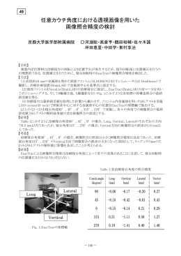 任意カウチ角度における透視画像を用いた 画像照合精度の検討