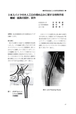 3本ス丿錠イク付き人工戸の埋め込みに関する特殊手術