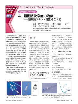 4． 頸動脈狭窄症の治療