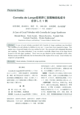 Cornelia de Lange症候群に盲腸軸捻転症を合併した1例