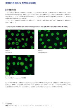 間接蛍光抗体法による抗核抗体写真集