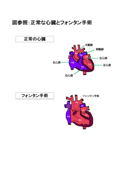 図参照：正常な心臓とフォンタン手術