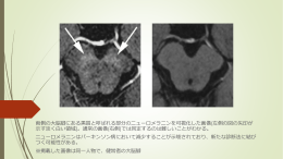 両側の大脳脚にある黒質と呼ばれる部分のニューロメラニンを可視化した
