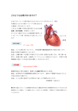 冠動脈バイパス手術について