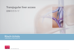 Transjugular liver access