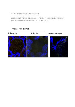 パイエル板内部に共生する Alcaligenes 菌 細菌特有の遺伝子配列を