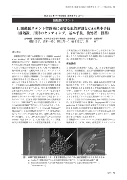 1. 頸動脈ステント留置術に必要な血管解剖とCAS基本手技