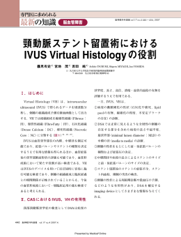 頸動脈ステント留置術における IVUS Virtual