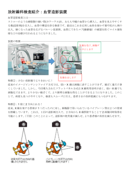放射線科検査紹介：血管造影装置