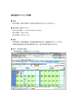 歯式設定タイミング改善