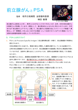 前立腺がんとPSA