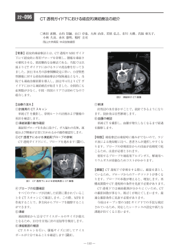 CT 透視ガイド下における経皮的凍結療法の紹介