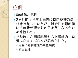 解説6 - PlaceHolder for csj