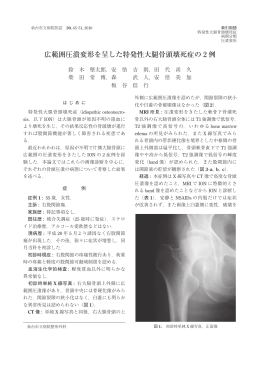 広範囲圧潰変形を呈した特発性大腿骨頭壊死症の 2 例