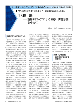 1）腫瘍  造影PET/CTによる転移・再発診断を中心に