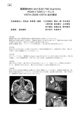 顎関節MRIにおける3D TSE Dual Echo （PDWI＋T2WI）シーケンス