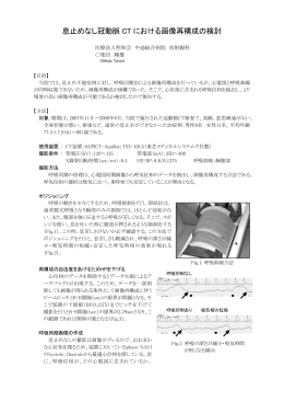 息止めなし冠動脈 CT における画像再構成の検討
