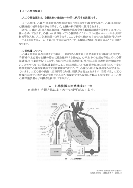 人工心肺装置の回路構成の一例 ＊ 疾患や手術方法