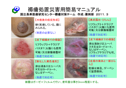 褥瘡処置災害用簡易マニュアル