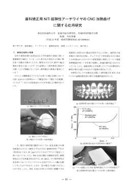 歯科矯 正用 NiT Ti 超弾性 に関 性アーチ 関する応用 チワイヤの 用研究