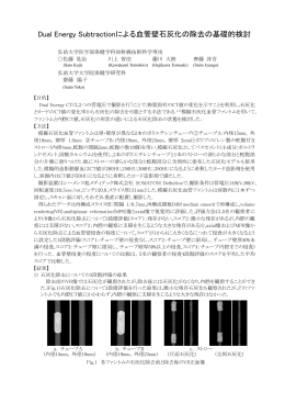 Dual Energy Subtractionによる血管壁石灰化の除去の基礎的検討