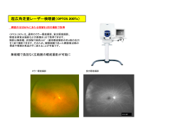 超広角走査レーザー検眼鏡（OPTOS 200Tx）
