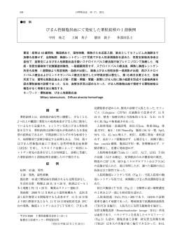 びまん性肺胞出血にて発症した粟粒結核の 1 剖検例