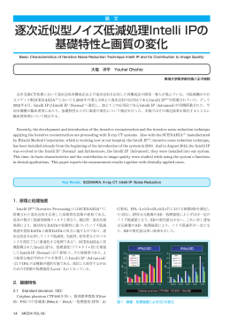 逐次近似型ノイズ低減処理Intelli IPの 基礎特性と画質の