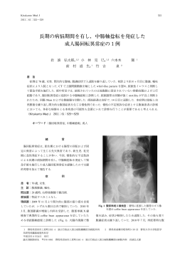 長期の病悩期間を有し，中腸軸捻転を発症した 成人腸回転