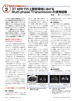 3T MRIでの上腹部領域における Multi-phase Transmissionの使用経験