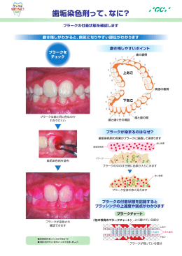 歯垢染色剤って、なに？