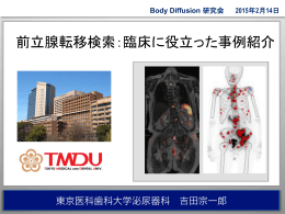 前立腺転移検索：臨床に役立った事例紹介