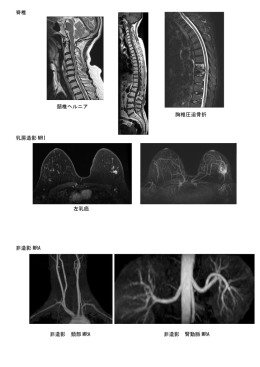 脊椎 頚椎ヘルニア 胸椎圧迫骨折 乳房造影 MRI 左乳癌 非造影 MRA 非