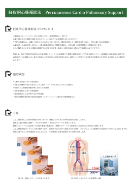 経皮的心肺補助法 Percutaneous Cardio Pulmonary Support