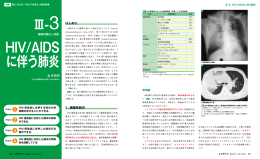 HIV/AIDS に伴う肺炎