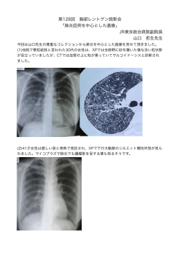 第128回 胸部レントゲン読影会 「肺炎症例を中心とした画像」 JR東京